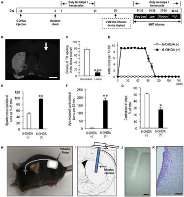 Intrastriatal Memantine Infusion Dampens Levodopa-Induced Dyskinesia and Motor Deficits in a Mouse Model of Hemiparkinsonism